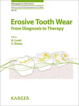 Lussi / Ganss |  Erosive Tooth Wear | eBook | Sack Fachmedien