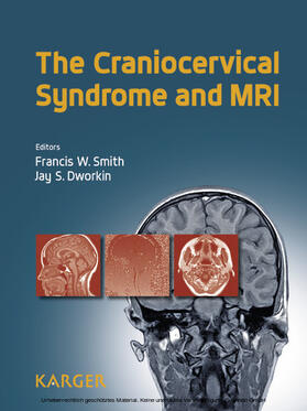 Smith / Dworkin |  The Craniocervical Syndrome and MRI | eBook | Sack Fachmedien