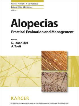 Ioannides / Tosti |  Alopecias - Practical Evaluation and Management | eBook | Sack Fachmedien