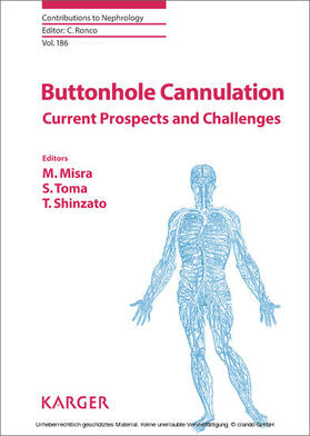 Misra / Toma / Shinzato |  Buttonhole Cannulation | eBook | Sack Fachmedien