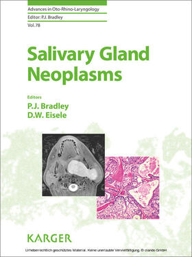 Bradley / Eisele |  Salivary Gland Neoplasms | eBook | Sack Fachmedien