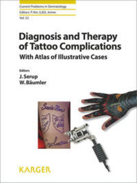 Serup / Bäumler |  Diagnosis and Therapy of Tattoo Complications | Buch |  Sack Fachmedien