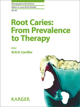 Rocha de Olivera Carrilho |  Root Caries: From Prevalence to Therapy | eBook | Sack Fachmedien