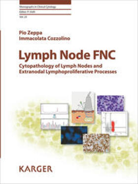 Zeppa / Cozzolino |  Lymph Node FNC | Buch |  Sack Fachmedien