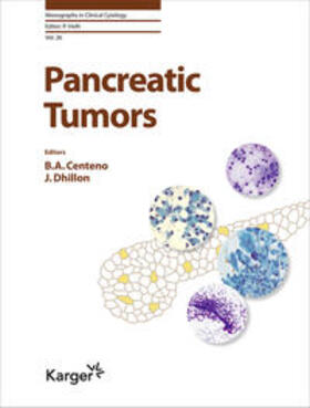 Centeno / Dhillon |  Pancreatic Tumors | Buch |  Sack Fachmedien