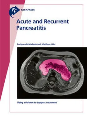 de-Madaria / Löhr |  Fast Facts: Acute and Recurrent Pancreatitis | Buch |  Sack Fachmedien