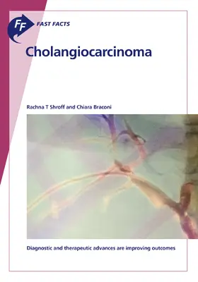 Shroff / Braconi | Fast Facts: Cholangiocarcinoma | E-Book | sack.de