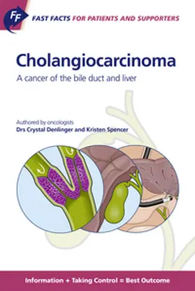 Denlinger / Spencer |  Fast Facts for Patients and Supporters: Cholangiocarcinoma | Buch |  Sack Fachmedien