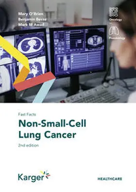 O'Brien / Besse / Awad |  Fast Facts: Non-Small-Cell Lung Cancer | Buch |  Sack Fachmedien