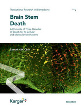 Chan |  Brain Stem Death | Buch |  Sack Fachmedien