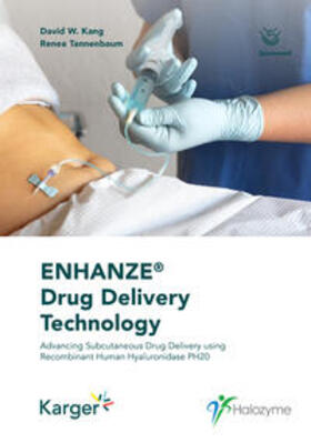 Kang / Tannenbaum | ENHANZE® Drug Delivery Technology | E-Book | sack.de