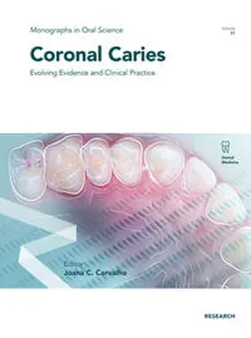 Carvalho / Lussi / Buzalaf |  Coronal Caries | Buch |  Sack Fachmedien