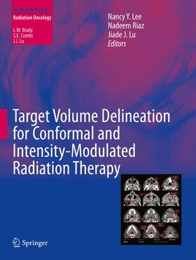 Lee / Riaz / Lu |  Target Volume Delineation for Conformal and Intensity-Modulated Radiation Therapy | Buch |  Sack Fachmedien