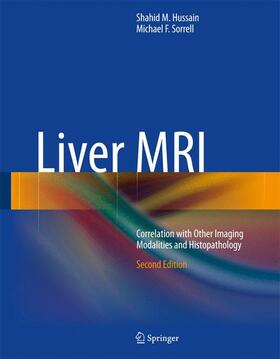 Hussain / Sorrell |  Liver MRI | Buch |  Sack Fachmedien