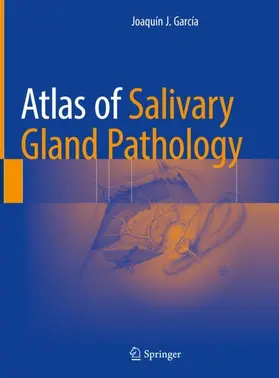 García |  Atlas of Salivary Gland Pathology | Buch |  Sack Fachmedien