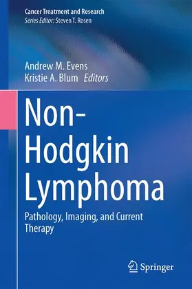 Blum / Evens |  Non-Hodgkin Lymphoma | Buch |  Sack Fachmedien