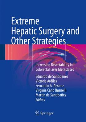 de Santibañes / Ardiles / Alvarez |  Extreme Hepatic Surgery and Other Strategies | Buch |  Sack Fachmedien