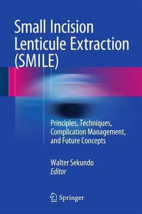 Sekundo |  Small Incision Lenticule Extraction (SMILE) | Buch |  Sack Fachmedien