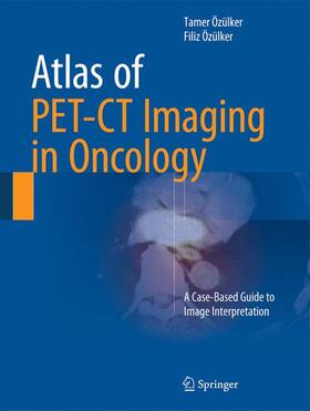 Özülker |  Atlas of PET-CT Imaging in Oncology | Buch |  Sack Fachmedien