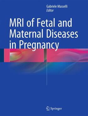Masselli |  MRI of Fetal and Maternal Diseases in Pregnancy | Buch |  Sack Fachmedien