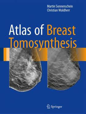 Waldherr / Sonnenschein |  Atlas of Breast Tomosynthesis | Buch |  Sack Fachmedien