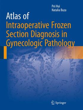Buza / Hui |  Atlas of Intraoperative Frozen Section Diagnosis in Gynecologic Pathology | Buch |  Sack Fachmedien