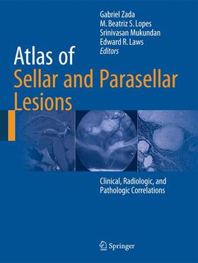 Zada / Laws Jr. / Lopes |  Atlas of Sellar and Parasellar Lesions | Buch |  Sack Fachmedien