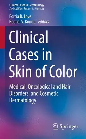 Kundu / Love |  Clinical Cases in Skin of Color | Buch |  Sack Fachmedien