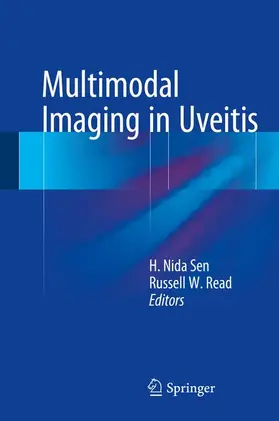 Read / Sen |  Multimodal Imaging in Uveitis | Buch |  Sack Fachmedien