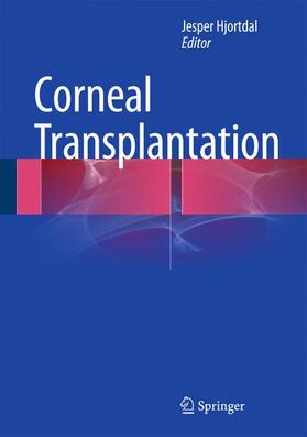 Hjortdal |  Corneal Transplantation | Buch |  Sack Fachmedien