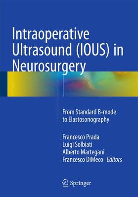 Prada / DiMeco / Solbiati |  Intraoperative Ultrasound (IOUS) in Neurosurgery | Buch |  Sack Fachmedien