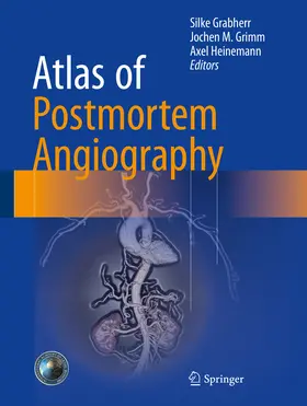 Grabherr / Grimm / Heinemann | Atlas of Postmortem Angiography | E-Book | sack.de