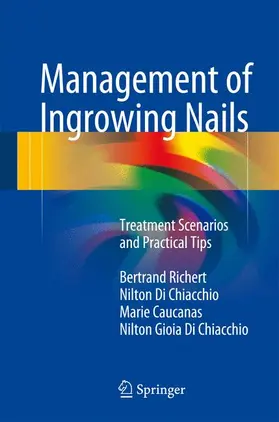 Richert / Di Chiacchio / Caucanas |  Management of Ingrowing Nails | Buch |  Sack Fachmedien