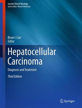 Carr |  Hepatocellular Carcinoma | Buch |  Sack Fachmedien