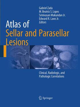 Zada / Laws Jr. / Lopes |  Atlas of Sellar and Parasellar Lesions | Buch |  Sack Fachmedien
