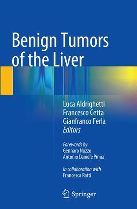 Aldrighetti / Ferla / Cetta |  Benign Tumors of the Liver | Buch |  Sack Fachmedien