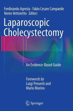 Agresta / Vettoretto / Campanile |  Laparoscopic Cholecystectomy | Buch |  Sack Fachmedien