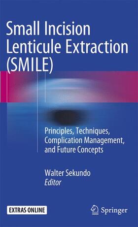 Sekundo |  Small Incision Lenticule Extraction (SMILE) | Buch |  Sack Fachmedien