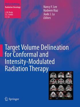 Lee / Riaz / Lu |  Target Volume Delineation for Conformal and Intensity-Modulated Radiation Therapy | Buch |  Sack Fachmedien