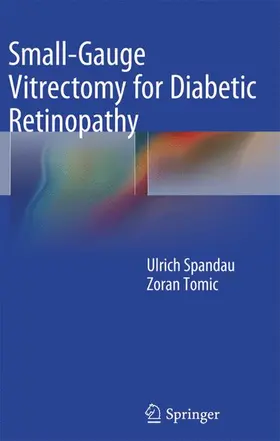 Spandau |  Small-Gauge Vitrectomy for Diabetic Retinopathy | Buch |  Sack Fachmedien