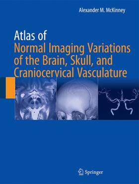 McKinney |  Atlas of Normal Imaging Variations of the Brain, Skull, and Craniocervical Vasculature | Buch |  Sack Fachmedien