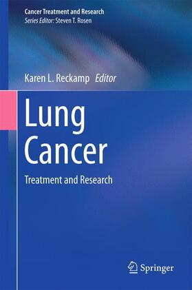 Reckamp |  Lung Cancer | Buch |  Sack Fachmedien