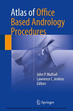 Mulhall / Jenkins |  Atlas of Office Based Andrology Procedures | eBook | Sack Fachmedien