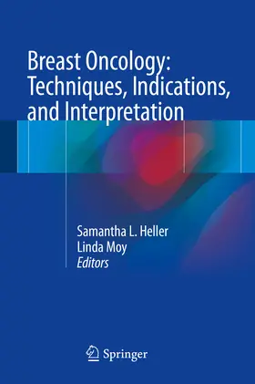 Heller / Moy |  Breast Oncology: Techniques, Indications, and Interpretation | eBook | Sack Fachmedien