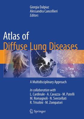 Dalpiaz / Cancellieri |  Atlas of Diffuse Lung Diseases | Buch |  Sack Fachmedien