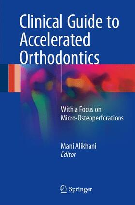 Alikhani |  Clinical Guide to Accelerated Orthodontics | Buch |  Sack Fachmedien