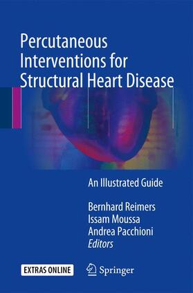 Reimers / Pacchioni / Moussa |  Percutaneous Interventions for Structural Heart Disease | Buch |  Sack Fachmedien