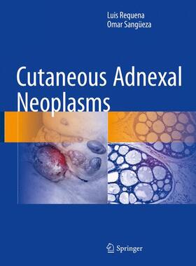 Requena / Sangüeza |  Cutaneous Adnexal Neoplasms | Buch |  Sack Fachmedien