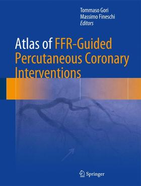 Fineschi / Gori |  Atlas of FFR-Guided Percutaneous Coronary Interventions | Buch |  Sack Fachmedien