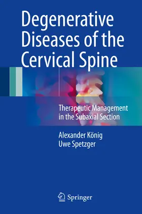 König / Spetzger |  Degenerative Diseases of the Cervical Spine | eBook | Sack Fachmedien